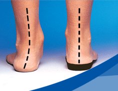 custom made insoles for flat feet